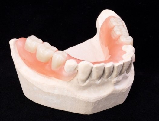 Model smile with partial denture